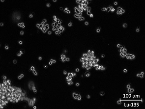 Brightfield micrograph of Lu-135, showing suspension/adherent growth, 20X magnification.