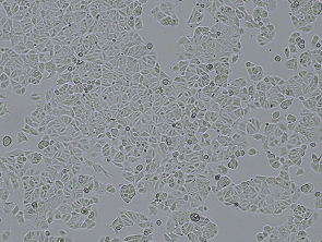 Brightfield micrograph of MCF7, showing adherent and/or suspension growth.