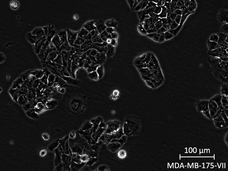 Brightfield micrograph of MDA-MB-175-VII, showing adherent growth, 20X magnification.