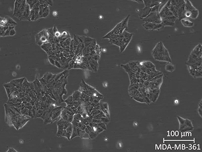 Brightfield micrograph of MDA-MB-361, showing adherent growth.