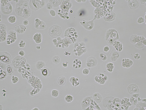 Brightfield micrograph of MDA-MB-415, showing adherent growth, 4X magnification.