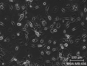 Brightfield micrograph of MDA-MB-436, showing suspension growth.