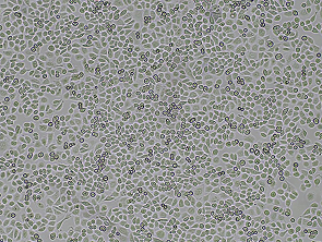 Brightfield micrograph of MDA-MB-468, showing adherent growth.