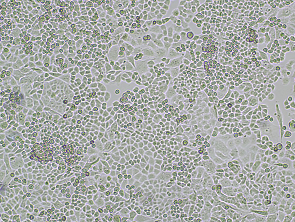 Brightfield micrograph of MFE-296, showing adherent growth, 4X magnification.