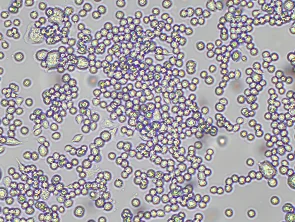 Brightfield micrograph of MH-S, showing adherent growth, 10X magnification.