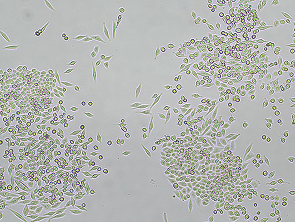 Brightfield micrograph of MIA PaCa-2, showing adherent growth, 4X magnification.