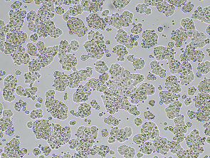 Brightfield micrograph of MIN-6, showing adherent growth, 4X magnification.
