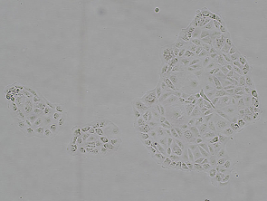 Brightfield micrograph of MKN-7, showing adherent growth.