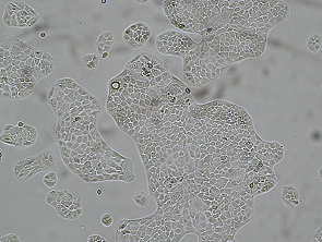 Brightfield micrograph of MKN-74, showing adherent growth.
