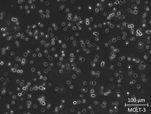 Brightfield micrograph of MOLT-3, showing suspension growth.