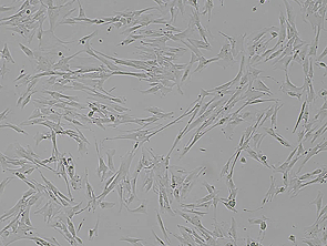 Brightfield micrograph of MRC-5, showing adherent growth.