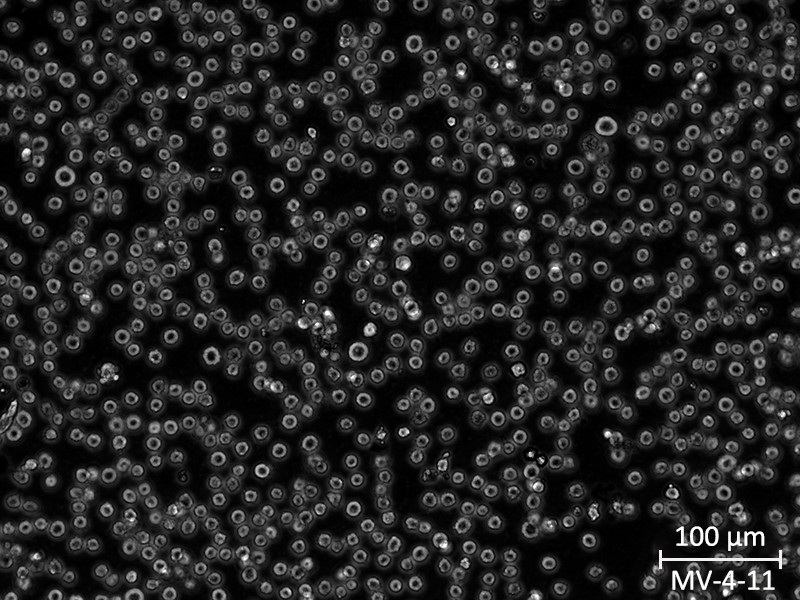 MV4-11 derived from acute myelomonocytic leukemia, exhibit round morphology in suspension; Scale bar at bottom right.