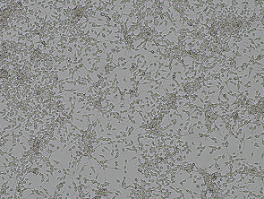 Brightfield micrograph of NB-1, showing adherent growth.