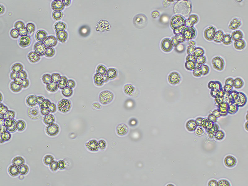 Brightfield micrograph of NCC-StC-K140, showing suspension growth, 10X magnification.