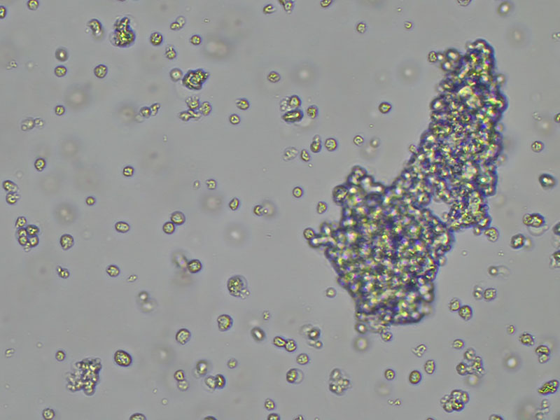 Brightfield micrograph of NCI-H146, showing suspension growth, 10X magnification.