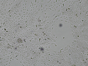 Brightfield micrograph of NCI-H292, showing adherent growth.
