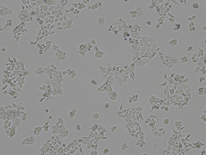 Brightfield micrograph of NCI-H322, showing adherent growth.