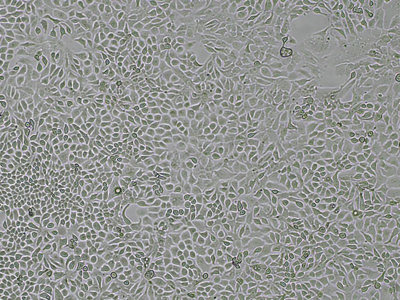 NCI-H322 