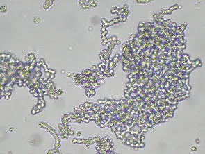 NCI-H82
