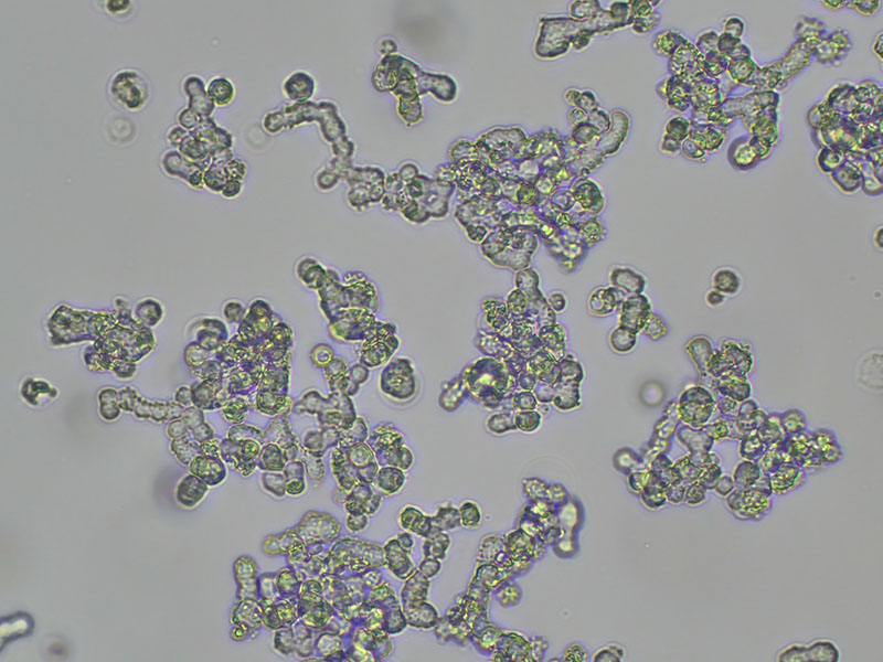 Brightfield micrograph of NCI-H82, showing suspension growth, 10X magnification.