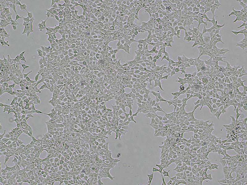 Brightfield micrograph of NEC8, showing adherent growth, 4X magnification.