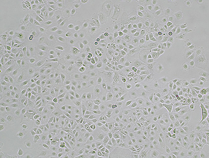 Brightfield micrograph of NIH: OVCAR-3, showing adherent growth, 4X magnification.