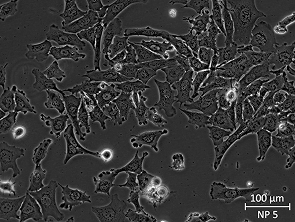 Brightfield micrograph of NP 5, showing adherent growth, 20X magnification.