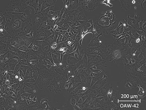 Brightfield micrograph of OAW42, showing adherent growth, 10X magnification.