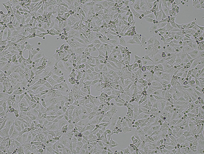 Brightfield micrograph of OAW-42, showing adherent growth.