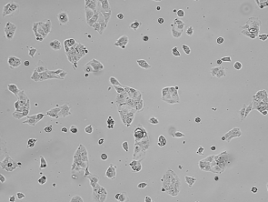 Brightfield micrograph of OAW28, adherent growth, 4X mag.