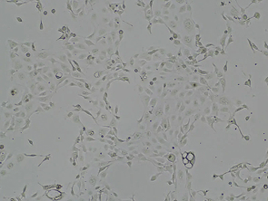 Brightfield micrograph of OE33, showing adherent growth.