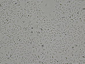 Brightfield micrograph of ONS-76, showing adherent growth.