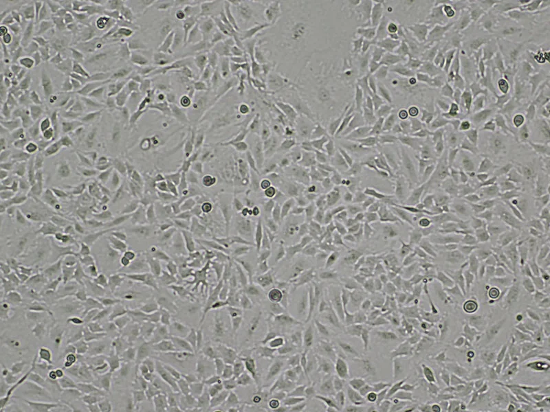 ONS-76 cell
