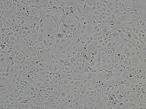 Brightfield micrograph of OS-RC-2, showing adherent growth.