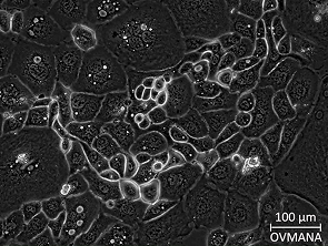 Brightfield micrograph of OVMANA, showing adherent growth.