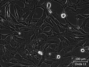 Brightfield micrograph of Onda 11, showing adherent growth, 20X magnification.