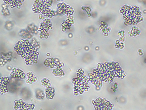 Brightfield micrograph of P30/OHK, showing suspension growth, 10X magnification.