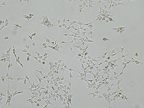 Brightfield micrograph of PA-1, showing adherent growth, 4X magnification.