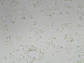 Brightfield micrograph of PANC-1, showing adherent growth, 4X magnification.