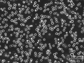 Brightfield micrograph of PL-21, showing suspension growth.