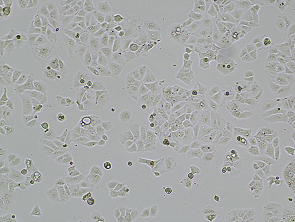 Brightfield micrograph of PLC-PRF-5, adherent growth, 4X mag.
