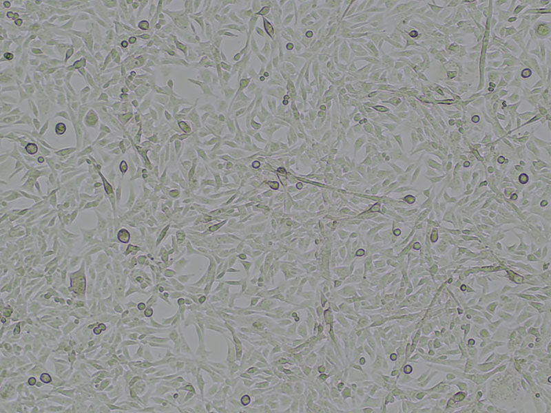 RD human rhabdomyosarcoma cells in suspension, exhibiting spindle-shaped morphology and are often multinucleated.