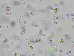 Brightfield micrograph of RPMI 8226, showing suspension growth, 10X magnification.