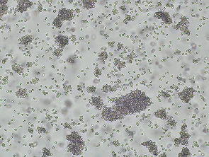 Brightfield micrograph of RPMI 8866, showing suspension growth, 4X magnification.