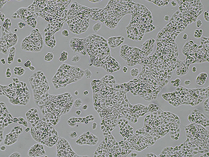 Brightfield micrograph of RT-112, showing adherent growth.