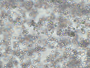 Brightfield micrograph of Ramos, showing suspension growth, 10X magnification.
