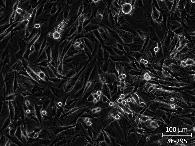 Brightfield micrograph of SF-295, showing adherent growth, 20X magnification.