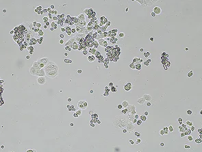 Brightfield micrograph of SHP-77, showing suspension and loose adhesion growth, 4X magnification.