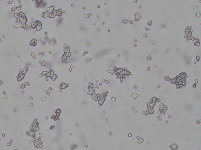 Brightfield micrograph of SHP-77, showing suspension growth, 4X magnification.