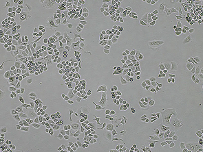 Brightfield micrograph of SK-BR-3, showing adherent growth.